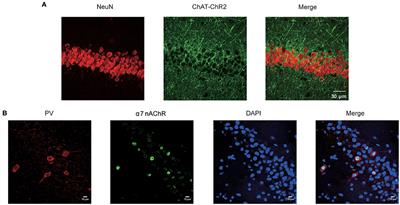 Nicotinic Acetylcholine Receptor α7 Subunit Is an Essential Regulator of Seizure Susceptibility